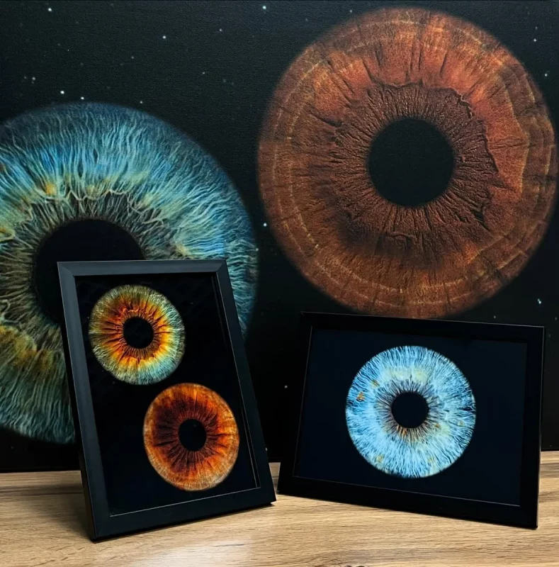 В Гродно можно сделать снимок радужки глаза - услуга нравится парам Снимок радужки